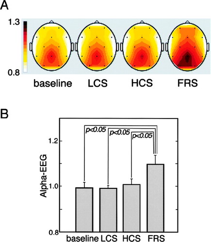 Musik untuk Seminar dan Motivator [Brand Awareness]